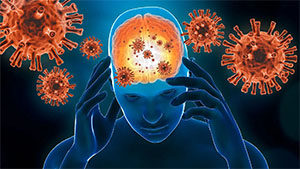 Brain Changes Seen After Mild COVID Infection